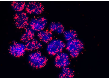 研究发现提出了靶向套细胞淋巴瘤的新方法