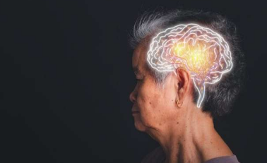 为什么阿尔茨海默氏症的大脑会产生胰岛素抵抗