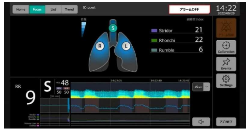 新型设备监测呼吸音以预测拔管后 ICU 患者的呼吸衰竭