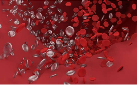 研究人员发现致命血栓的新机制