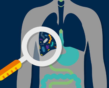 肺微生物组可能有助于预测危重患者的预后